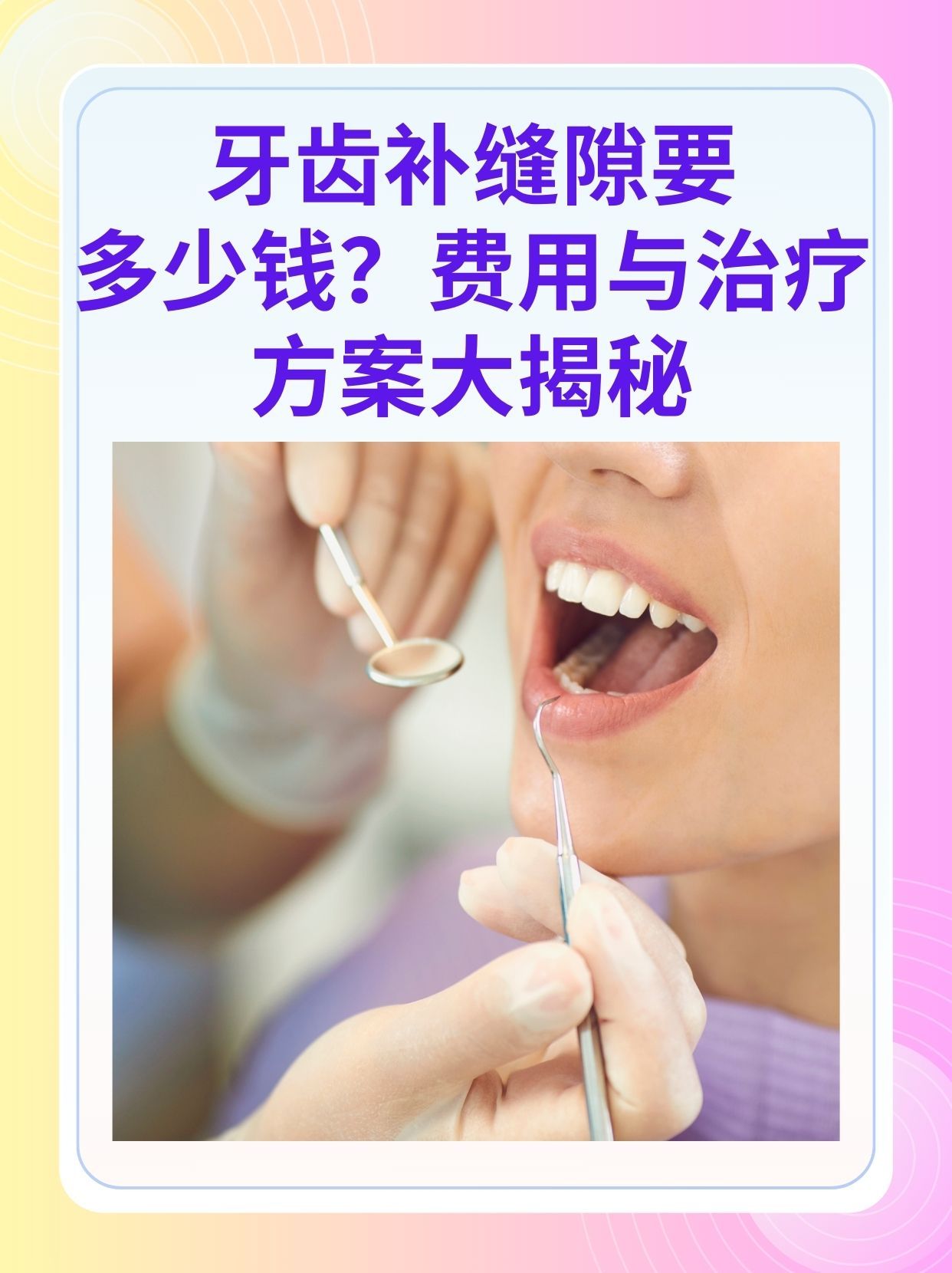 重庆补牙医保可以报销吗(补牙医保可以报销吗 哪些可以报销呢)